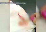 В Надыме санитарка поглумилась над оторванным пальцем пациентки (ВИДЕО)