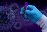 В России количество заболевших коронавирусом может вырасти до 100 тысяч человек в сутки
