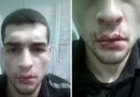 Два заключенных тюменской колонии зашили себе рты в знак протеста