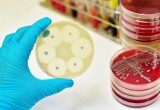 Резистентность бактерий к антибиотикам - одна из главных проблем здравоохранения