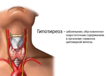 Чем опасен гипотиреоз 