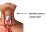 Чем опасен гипотиреоз 