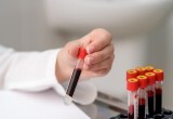 Негативные последствия вредных привычек